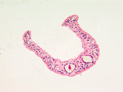 Micrograph of human parasite Schistosoma mansonii