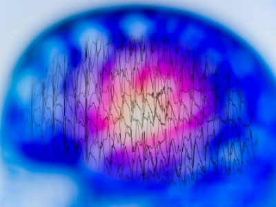 EEG showing brain activity