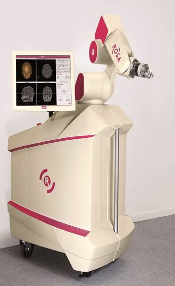 ROSA robot used in epilepsy surgery