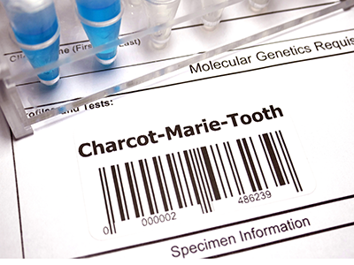 Charcot-Marie-Tooth diseas form