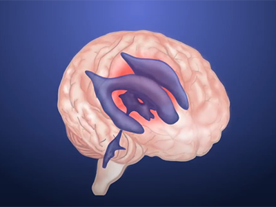 illustration of brain with stem cells