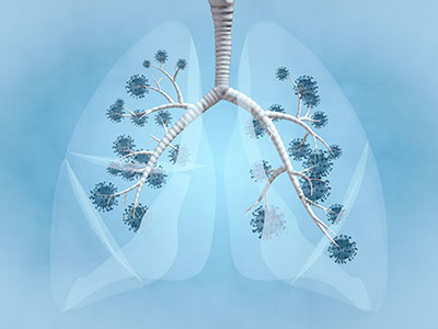 illustration of lungs with coronavirus inside