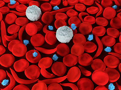 red blood cells with sickle cell disease