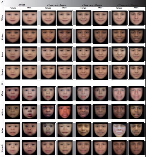 Grid of children's faces being studied by a genetic screening machine learning tool