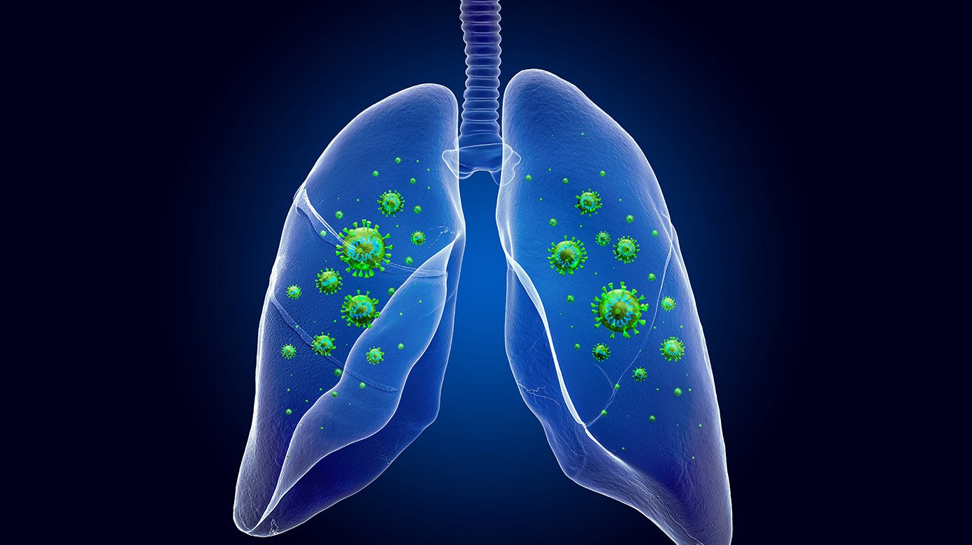 Illustration of lungs with viral particles inside