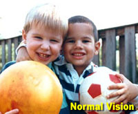 Simulation photograph: normal vision